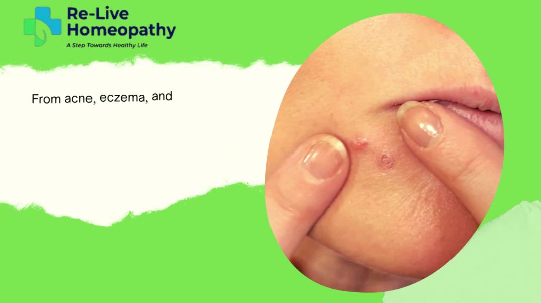 Best Homeopathic Skin Doctor in Lucknow